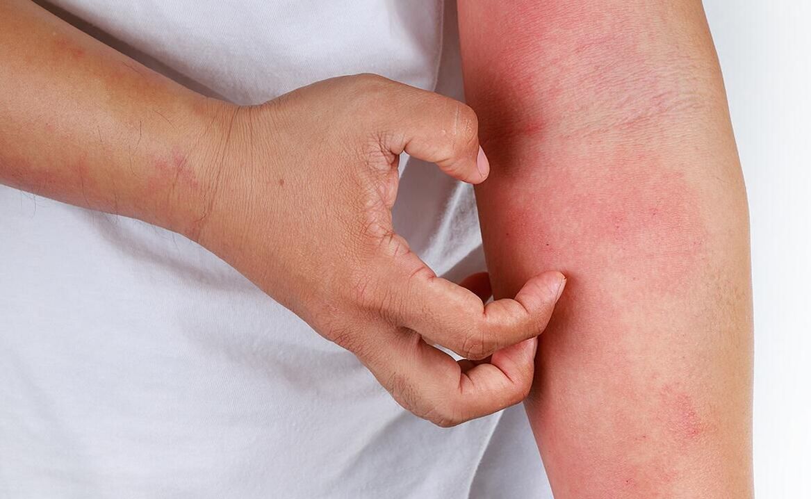 possibili complicazioni derivanti dall'uso della soda