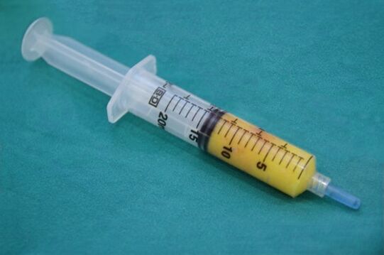Siringa con tessuto adiposo per lipofilling